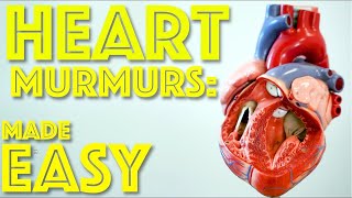 Grading of Systolic Murmurs  Levines Grading [upl. by Yekcin45]