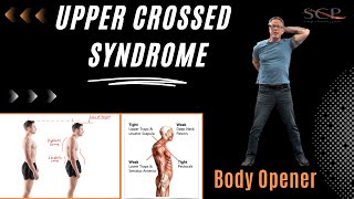 Upper Crossed Syndrome Body Opener [upl. by Ivon60]