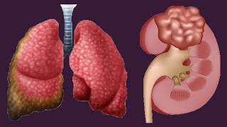 Low And High Hematocrit Levels Causes And Symptoms [upl. by Grindle]