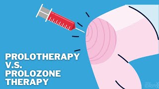 Prolotherapy VS Prolozone Therapy What is the difference and which one is for you [upl. by Muriah705]