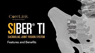 CoreLink Siber® Ti Sacroiliac Joint Fusion System—Features and Benefits [upl. by Hallsy]