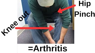 Classic Sign of Hip ArthritisThis is the SIMPLEST test to identify it [upl. by Notnilc]