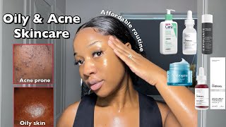 SKINCARE ROUTINE FOR OILY ACNEPRONE SKIN  A routine for smooth amp clear Skin ‼️ [upl. by Adnam]