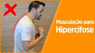 Exercícios de musculação para melhorar a postura  hipercifose torácica  Fisioprev  2 Parte [upl. by Eldwen]