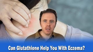 Can Glutathione Help You With Eczema [upl. by Clifford]