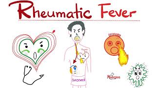 Rheumatic Fever  Jones Criteria  Causes Signs Symptoms Diagnosis amp Treatment  Cardiology [upl. by Wayolle267]