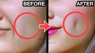 25MINS🔥 How To Get DIMPLES Fast amp Naturally Simple Facial Exercises to get Dimples without Surgery [upl. by Marci]