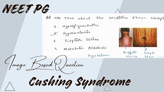 Cushing Syndrome  Image based questions  for NEET PG [upl. by Kinnon]