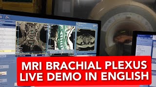 Brachial plexus MRI scan protocol positioning and planning on GE 15 Tesla  Live Demo in English [upl. by Navoj]