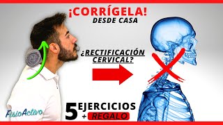 5 EJERCICIOS para la CORREGIR TU CUELLO ¡EN POCO TIEMPO 🩻  REGALO 🎁 [upl. by Anaira]