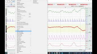 Analysis  Impedance Cardiography  Preferences Bpoint location R to C polynomial model  Graph [upl. by Stoller]