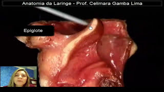 Anatomia da Laringe  Prof Celimara [upl. by Crosby]