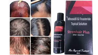 Strenhair Plus Topical Solution SPRAY SOLUTION Minoxidil amp Finasteride Topical Solution [upl. by Giamo]