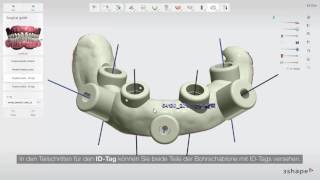 3Shape Implant Studio – Zahnloser Kiefer  5 Bohrschablonen erstellen [upl. by Nimad]