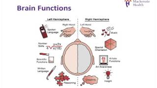 Stroke Education  Causes and Effects [upl. by Bully980]