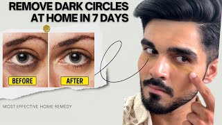 Remove Dark Circles in 7 Days How to remove dark circles at home [upl. by Michelle]