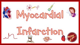 Myocardial InfarctionHeart Attack Causes Pathogenesis Signs amp Symptoms Diagnosis amp Treatment [upl. by Annatsirhc]