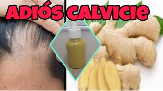 CRECE TU CABELLO EN 1 SEMANA CON ESTE TÓNICO DE ROMERO CASERO  NatyGloss [upl. by Ewold]