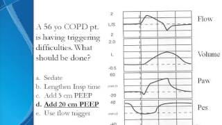 Problems in Mechanical Ventilation [upl. by Burlie]