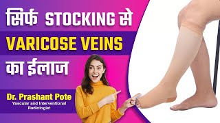 Varicose Veins Care How to Choose and Use Stockings Complete Guide by Dr Prashant Pote [upl. by Ashjian]