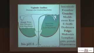 Ausfluss aus der Scheide  Ursachen und Auswirkungen  Schleimhautentzündung und Krampfadern [upl. by Atteram600]