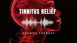 Relaxing Music For Tinnitus Sound Therapy [upl. by Ayadahs]