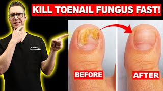 1 BEST Toenail Fungus Treatment Top 10 Home Remedies 2024 [upl. by Leasa818]