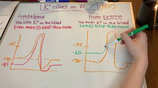 How does hypokalemiahyperkalemia affect the resting membrane potential RMP [upl. by Noside]