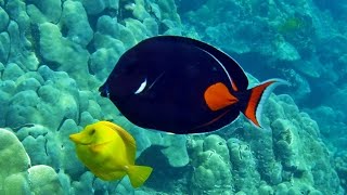 Facts The Achilles Tang [upl. by Daly303]