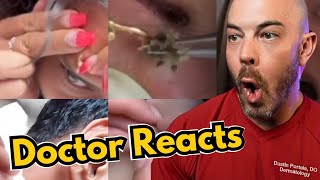 Dermatologists Reaction to Viral Pimple Popping Cyst Popping TikToks [upl. by Gerstein736]