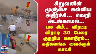 சிறுவனின் மூஞ்சை கவ்விய அதிர்ச்சி 30 பேரை குதறிய கொடூரம் கதிகலங்க வைக்கும் காட்சி [upl. by Enilkcaj]