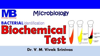 BIOCHEMICAL TEST  Bacterial Identification Technique  Microbiology  Vivek Srinivas Bacteriology [upl. by Oigile294]