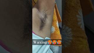 Waxing🥵🥵🥵waxtrandingviralviralreelsskincarebodywaxingviralvideohairremovalbikne underarms [upl. by Ynohtnanhoj56]