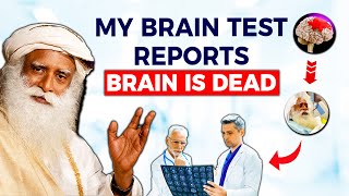 Sadhguru’s BRAIN TEST REPORTS  REVEALED  What Doctors Said  Sadhguru Darshan [upl. by Tallula45]