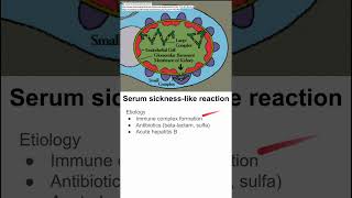 Serum sicknesslike reaction [upl. by Eecyac748]