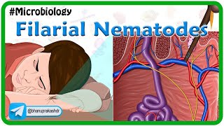 Filarial nematodes Animation🐛 Wuchereria onchocera volvulus LoaLoa Dracunculus Trichinella [upl. by Raney]