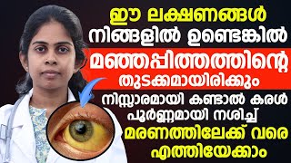 ഈ ലക്ഷണങ്ങൾ നിങ്ങളിലുണ്ടോമഞ്ഞപ്പിത്തത്തിന്റെ ലക്ഷണമാണ് [upl. by Beckett]