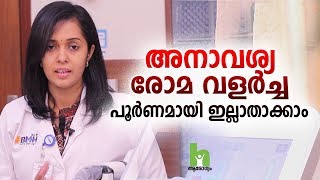 അനാവശ്യ രോമ വളർച്ച പൂർണമായും ഇല്ലാതാക്കാം  Laser Hair Removal Malayalam Health Tips [upl. by Roosnam]