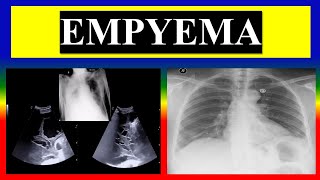 EMPYEMA  define  factors  pathophysiology  clinical  diagnostic  management [upl. by Quinby68]