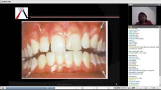 Periodontics  Gingiva and Tooth Supporting Structure [upl. by Nostrebor]