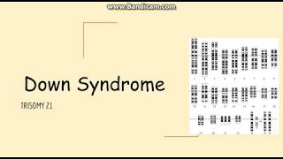 Trisomy 21 How it Occurs at the Molecular Level [upl. by Adirem]