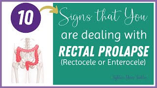 10 Signs that you are dealing with Rectal Prolapse Rectocele [upl. by Kcirddahc]