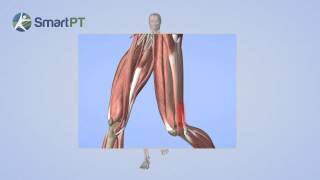 Tensor Fascia Latae Syndrome [upl. by Tatiana]