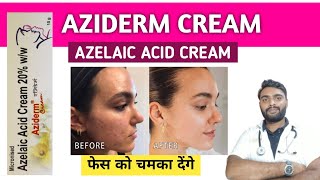 Azelaic acid cream  How to use azelaic acid cream  Best azelaic acid cream  Aziderm cream [upl. by Dannel]