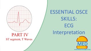 OSCE ESSENTIALS  ECG INTERPRETATION PART 4  ST segment and T waves [upl. by Ynnavoig889]