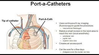 24 Principles of Port A Cath Placement amp Management [upl. by Man329]