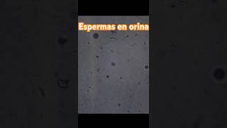 ESPERMAS en una muestra de orina [upl. by Ataymik]