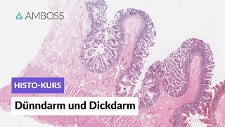 Histologie Dünndarm und Dickdarm  Mikroskopische Anatomie  AMBOSS Video [upl. by Ursa]