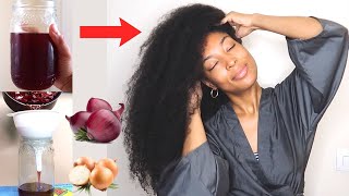 HOW TO USE ONION DECOCTION FOR MASSIVE HAIR GROWTH  ONIONS FOR EXTREME HAIR GROWTH [upl. by Foster476]