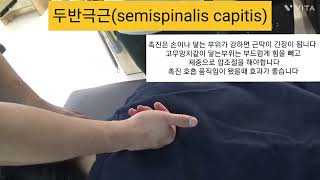 두반극근  semispinalis capitis  촉진및 도수운동 ㅡ뒷목과 등이 뻐근하다면 이 근육일수도 있습니다 목틍증 등통증 [upl. by Yevrah196]